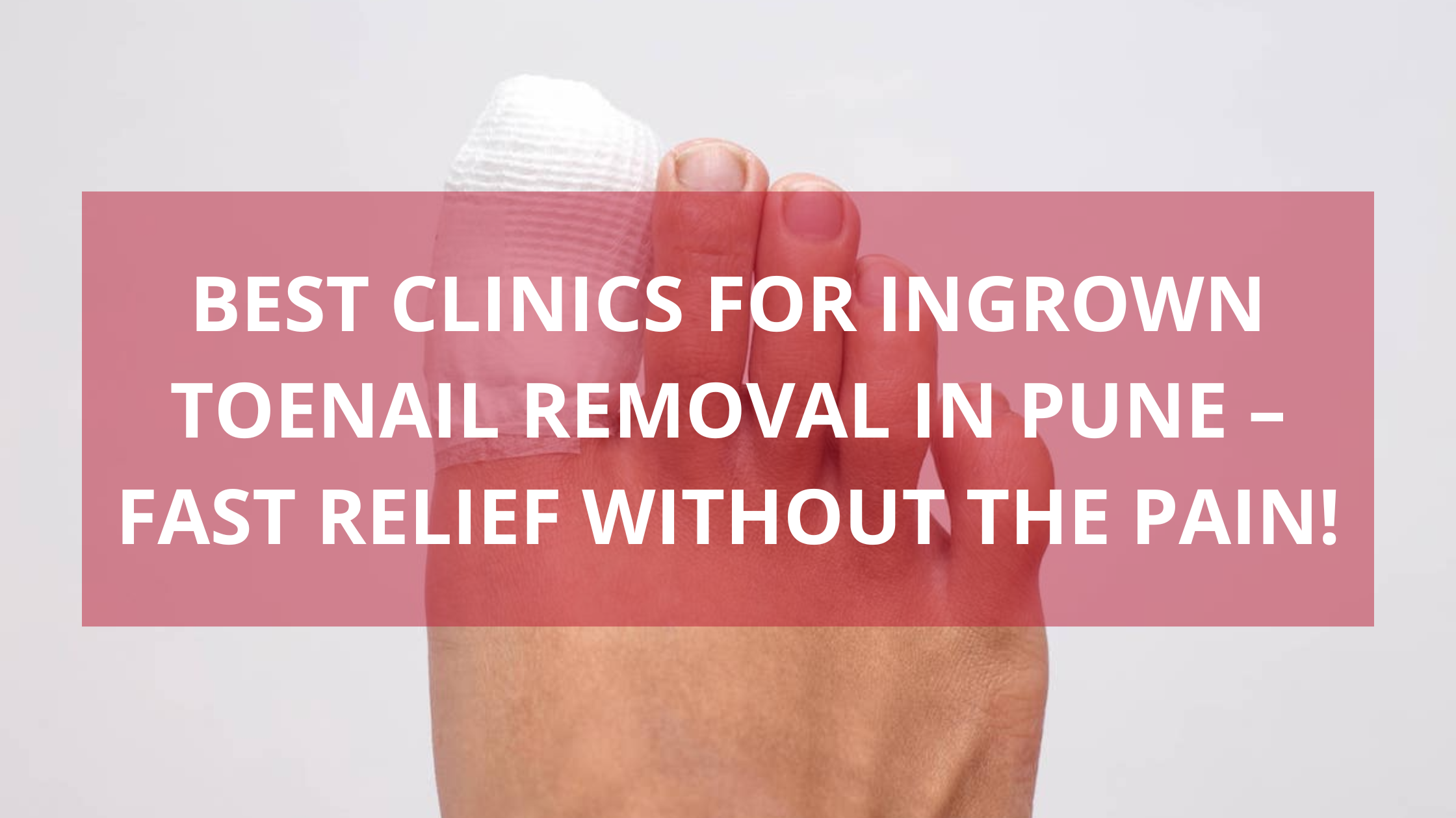 Ingrown Toenail Removal in Pune